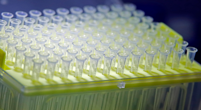 Photo: test tubes in a medical laboratory